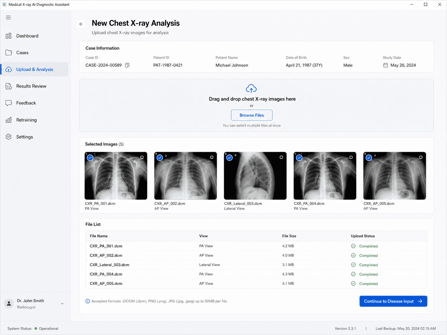 Medical X-ray AI Diagnostic Assistant preview 2
