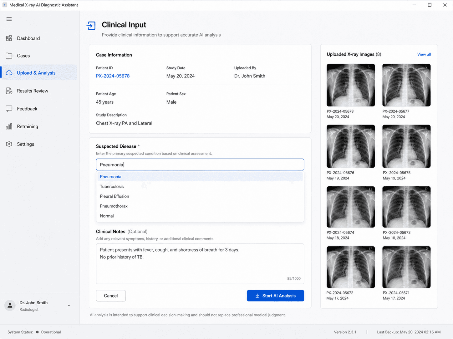 Medical X-ray AI Diagnostic Assistant preview 3