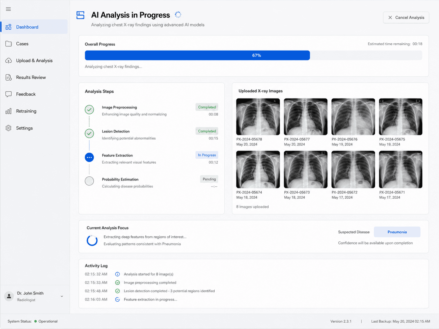 Medical X-ray AI Diagnostic Assistant preview 4