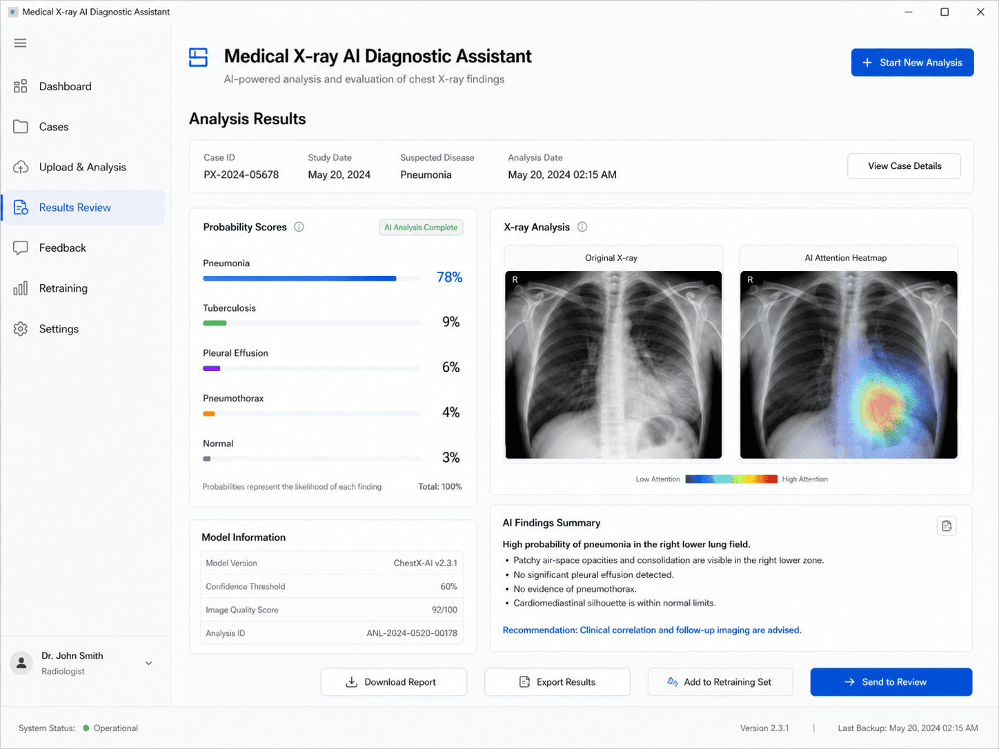 Medical X-ray AI Diagnostic Assistant preview 5