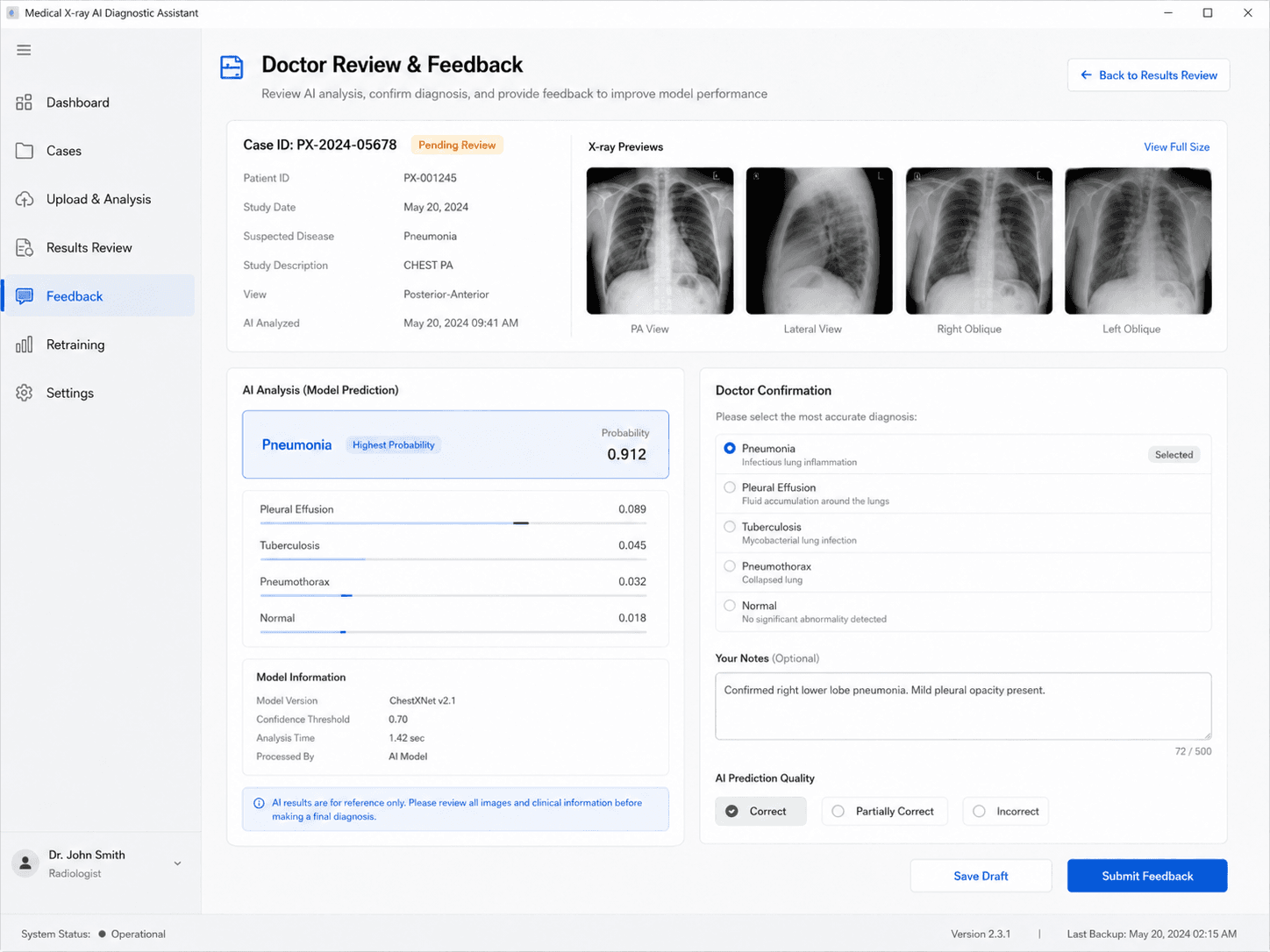 Medical X-ray AI Diagnostic Assistant preview 6